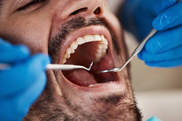 Best Emergency Care for Gum Disease in North El Monte, CA